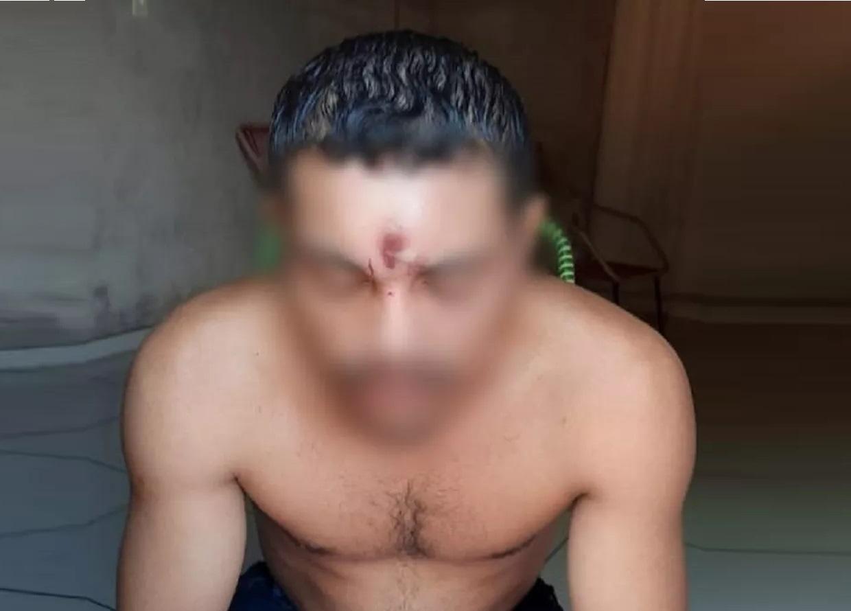 Homem leva tiro na testa, cai de moto e vai para casa dormir em Araguaína - TO